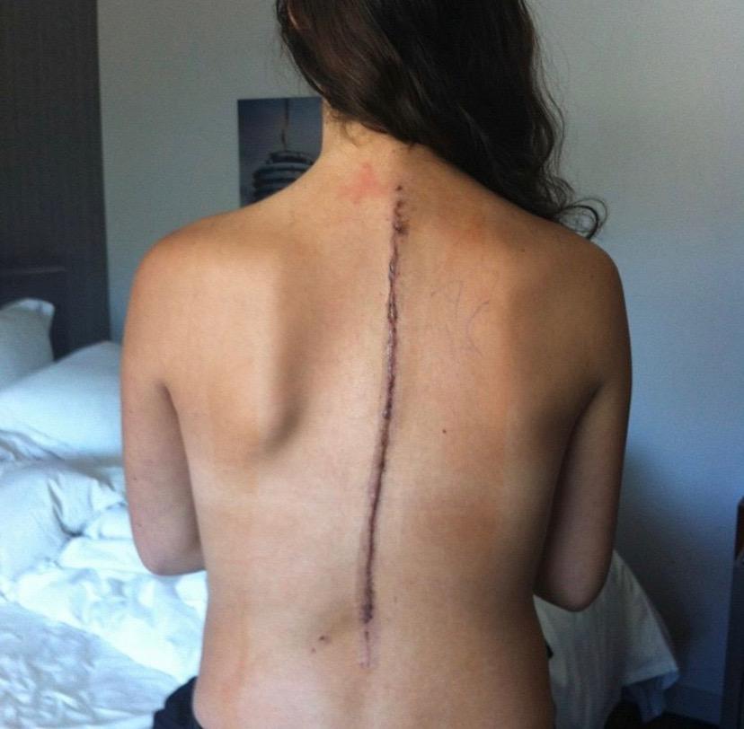 Scars are Beautiful.